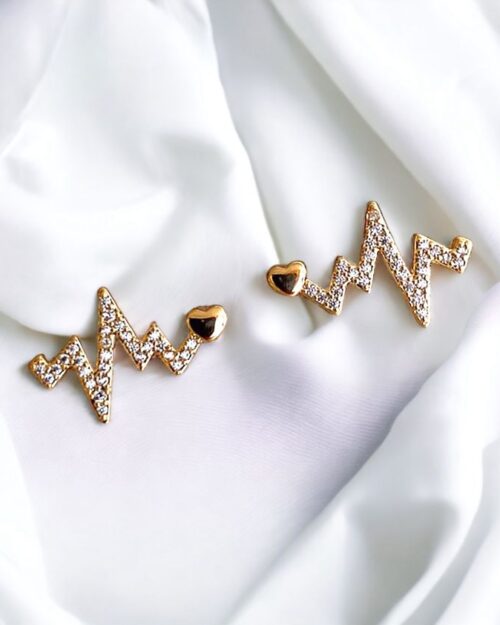 Aretes EKG